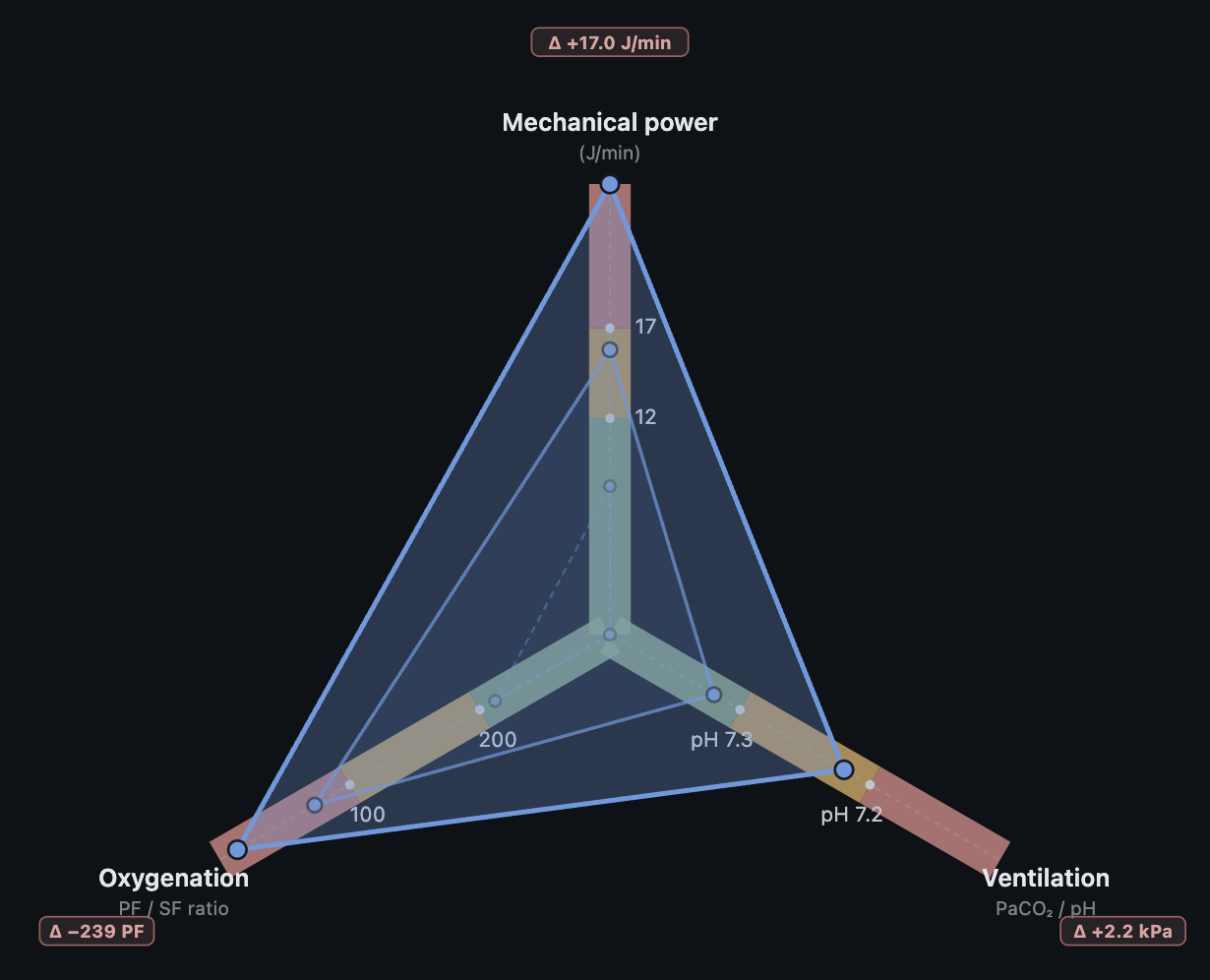 Ventilation Constraint Model polygon — representative illustration